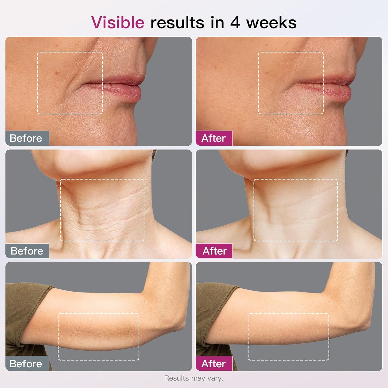 Microcurrent Facial Device 4-in-1 Beauty Device