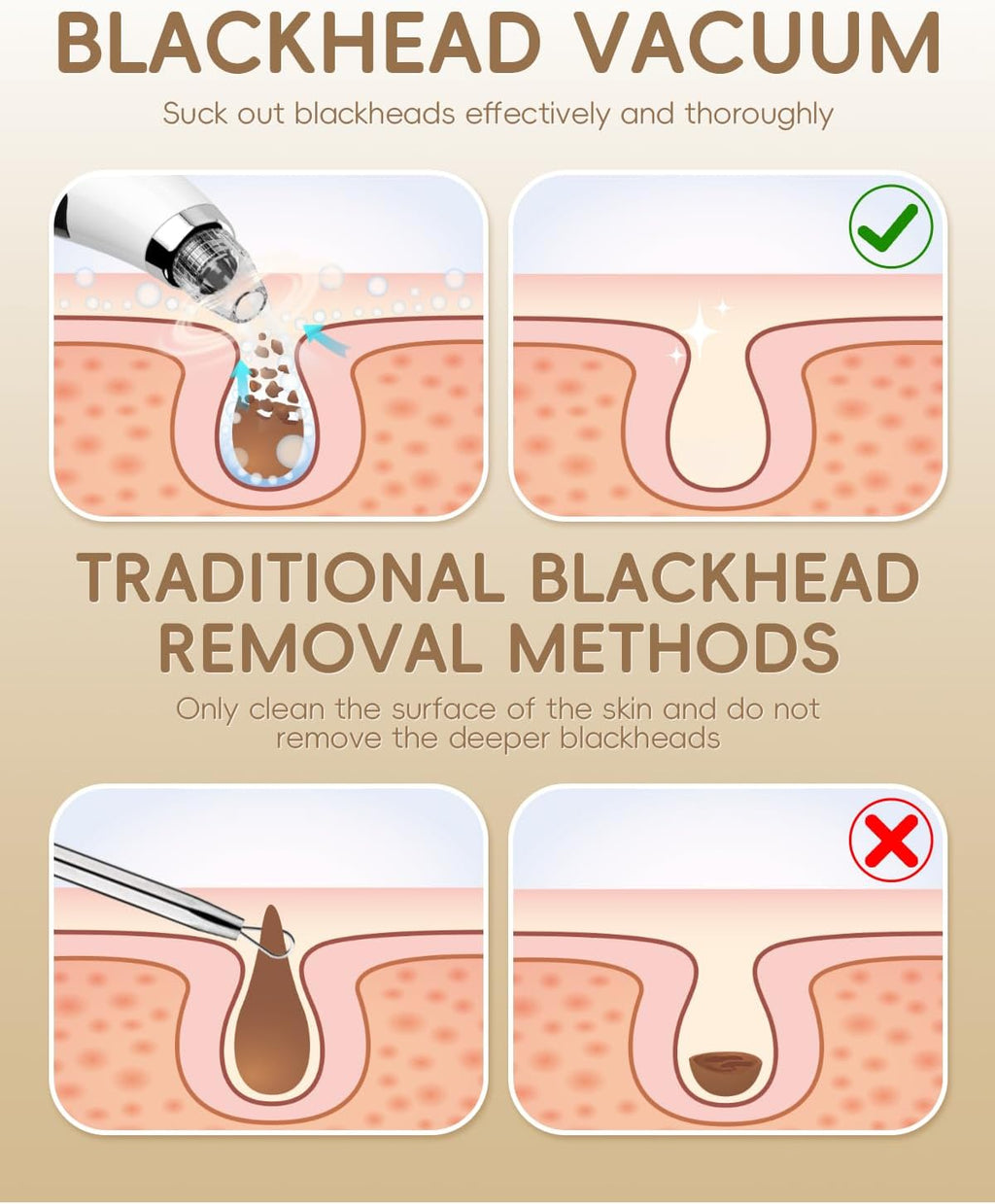 Pore Vacuum Blackhead Remover