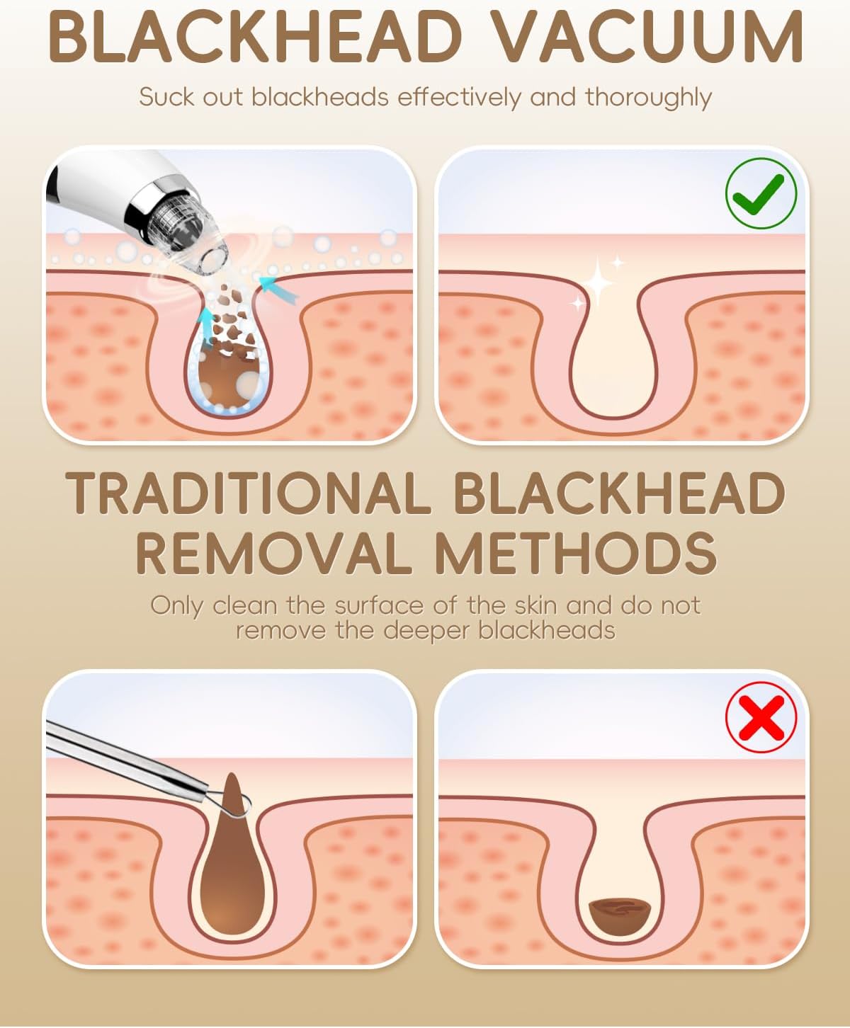 Pore Vacuum Blackhead Remover