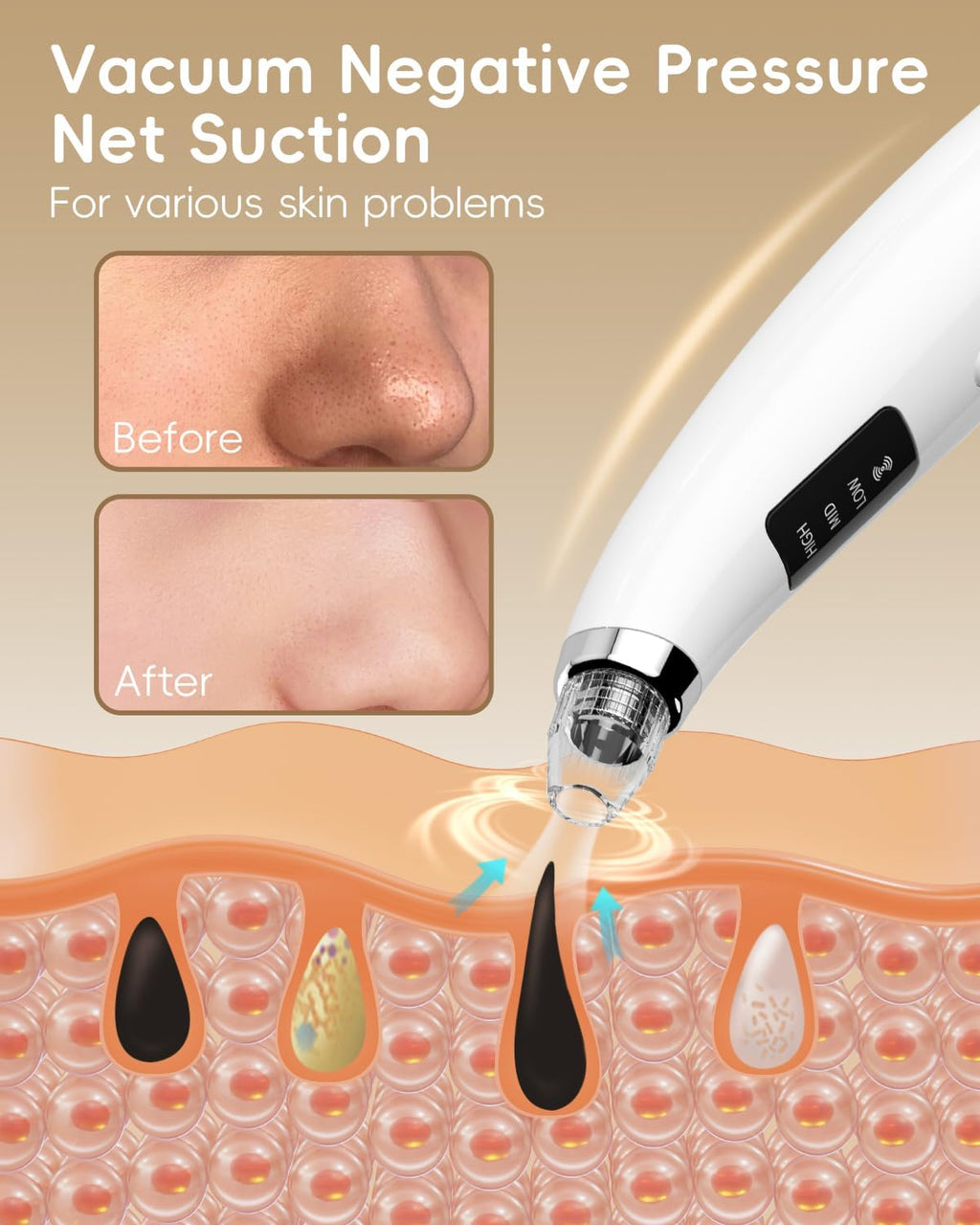 Pore Vacuum Blackhead Remover