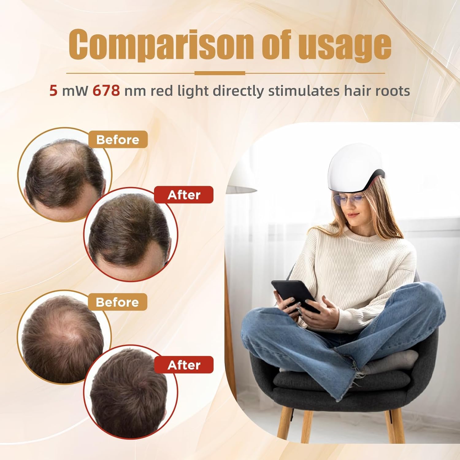 Hair Growth Low Level Laser Therapy