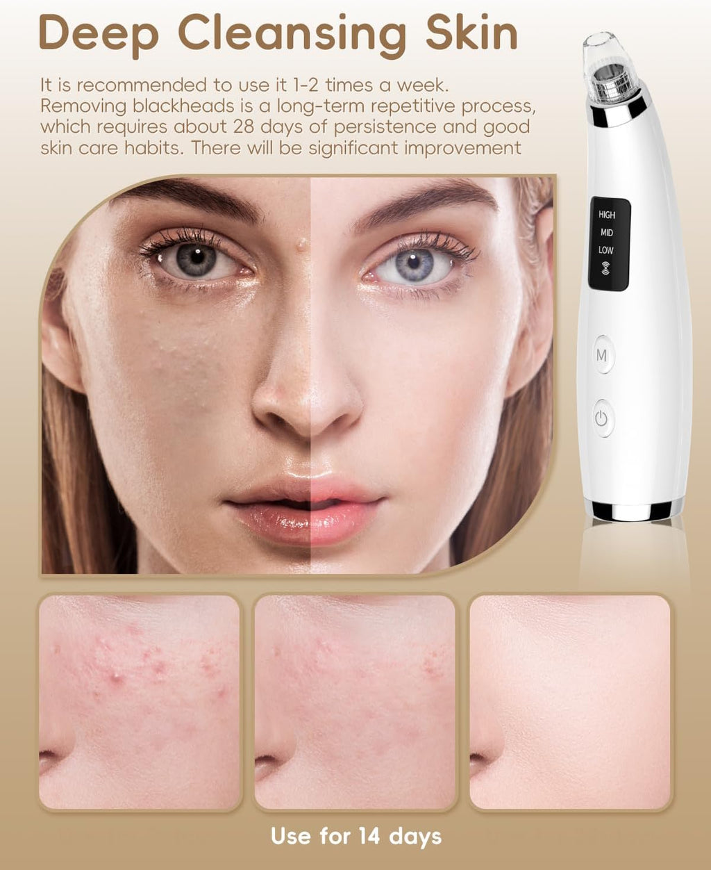 Pore Vacuum Blackhead Remover