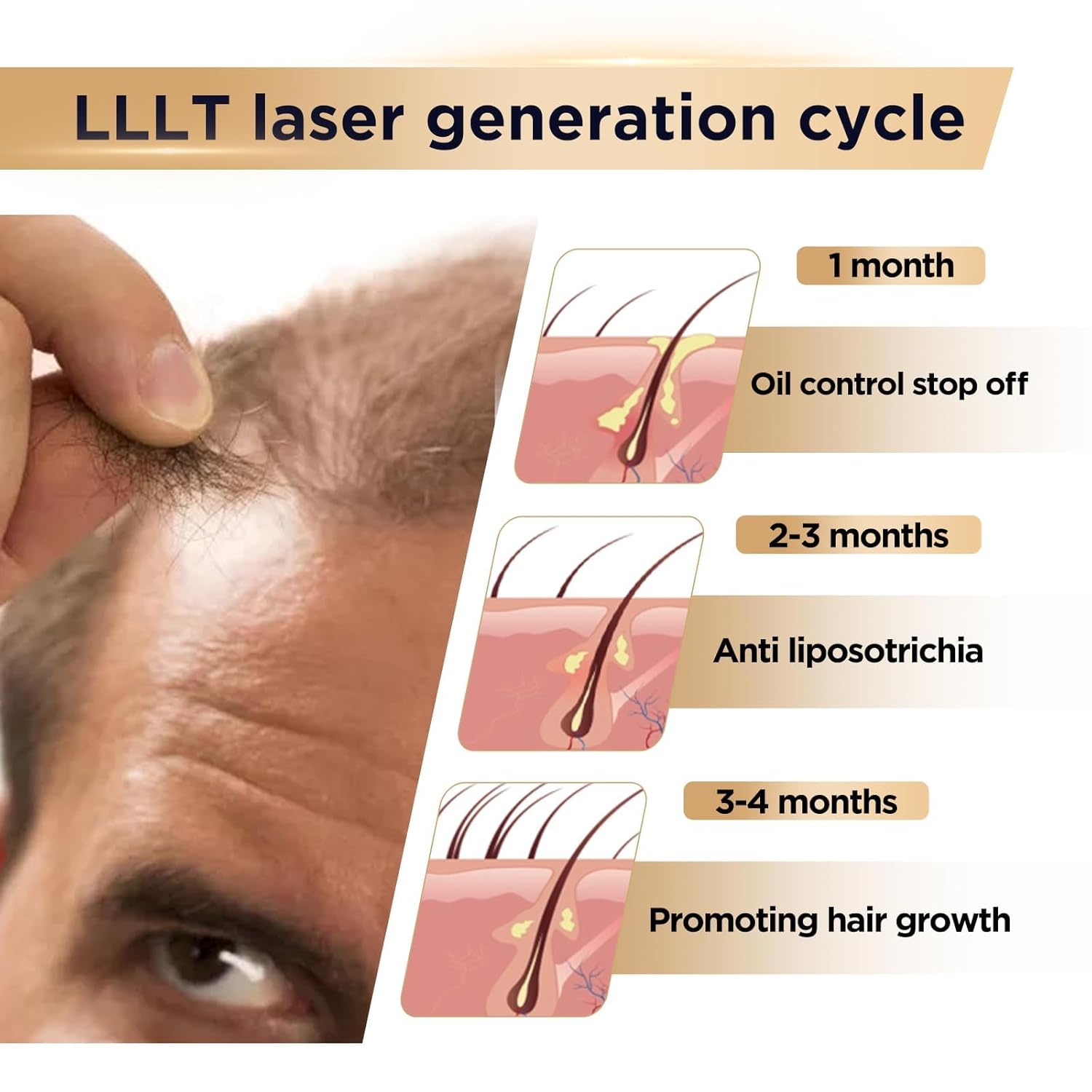 Hair Growth Low Level Laser Therapy